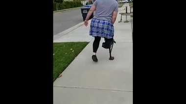 BBW amputee RBK using I-Walk