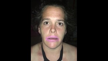 Spitting, slapping and choking sample