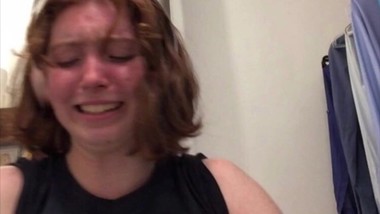 Ginger teen peels her sunburn